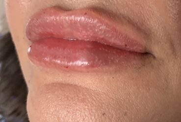 New Lips 👄 Labios Nuevos