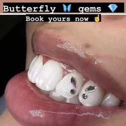 Teeth Gems Teeth Gems