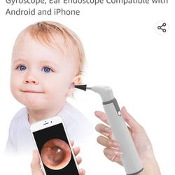 ScopeAround Digital Otoscope