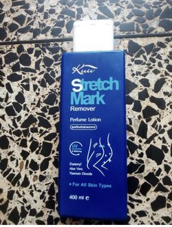 Stretch mark remover