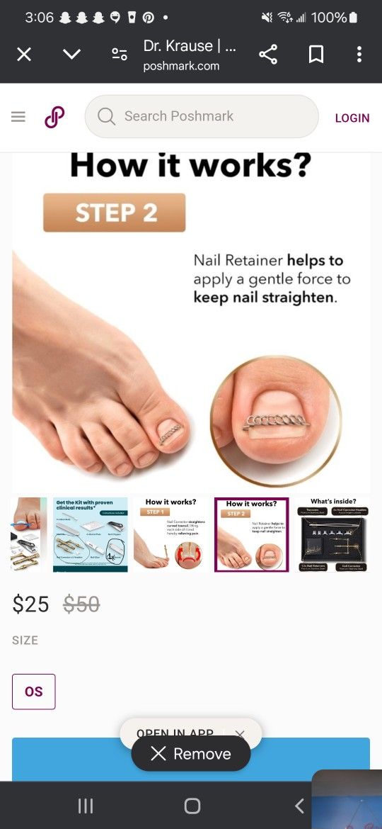 Ingrown Nail Corrector Kit