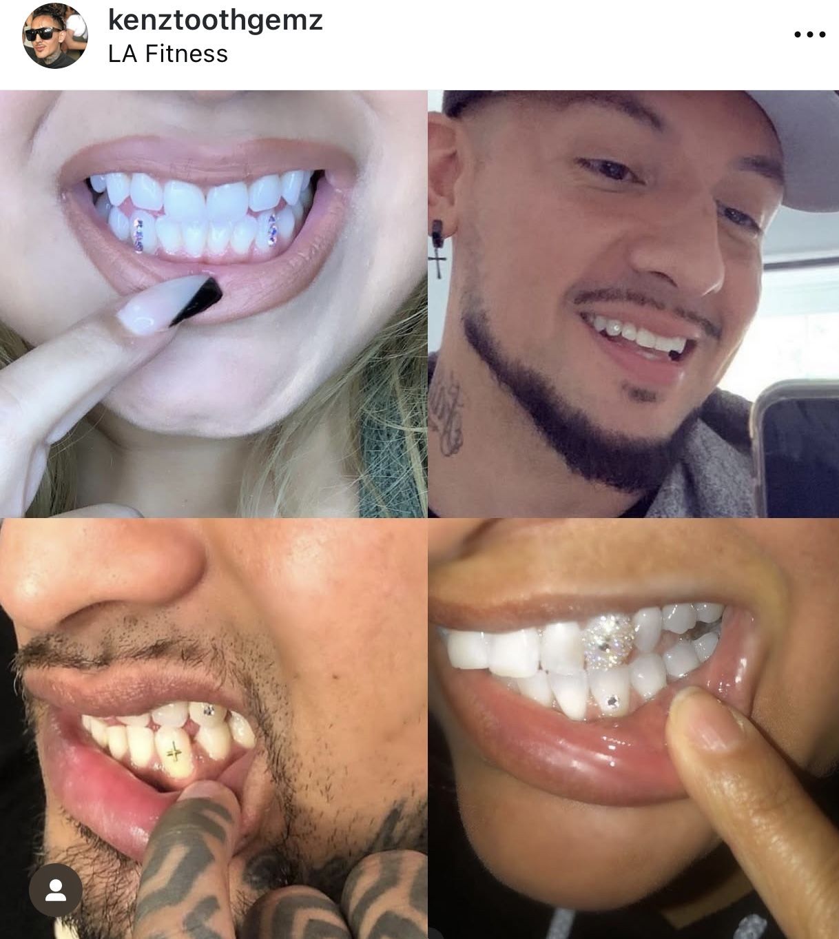 Tooth Gems