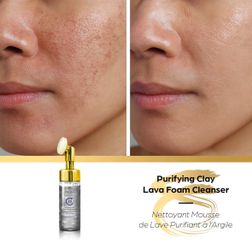 Secret Collagen Purifying Clay Lava Foam Cleanser.