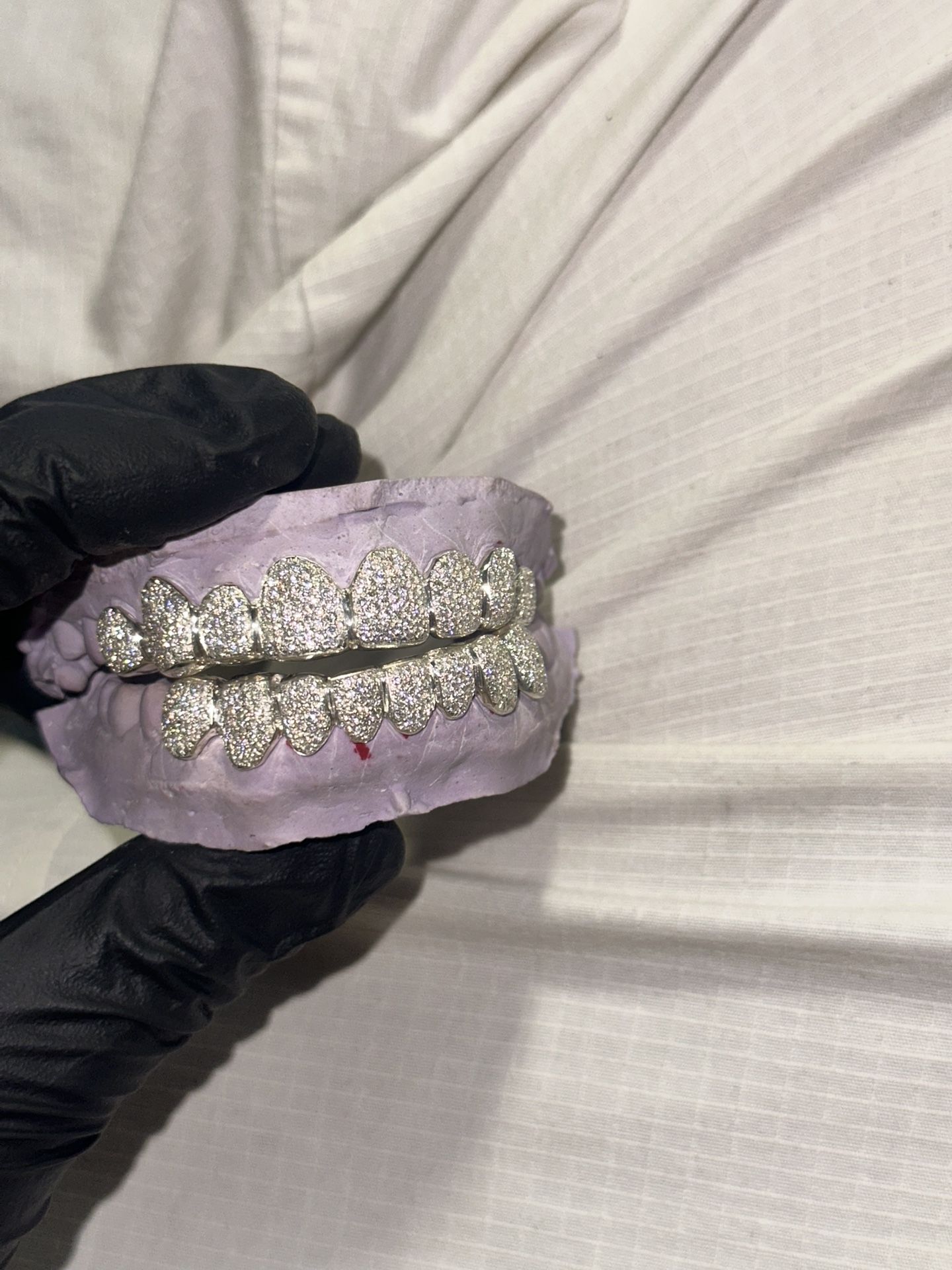 VVS MOISSANITE GRILLZ 💎