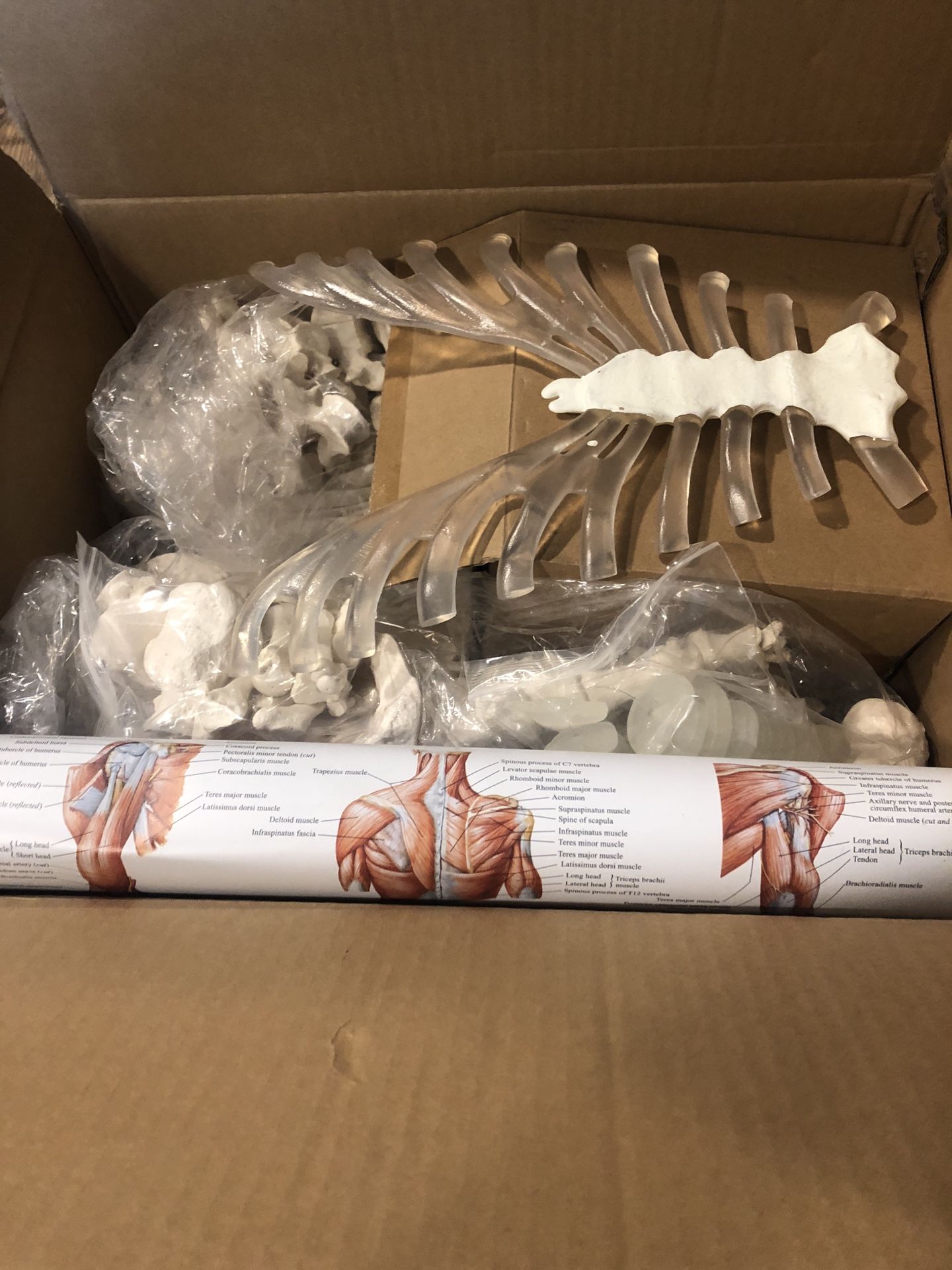 Disarticulated Skeleton