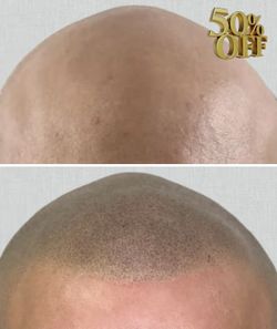 Instant Permanent Density 