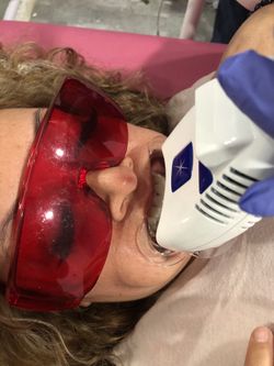 Cosmetics Teeth  Whitening/Blanquiamiento De Dientes 