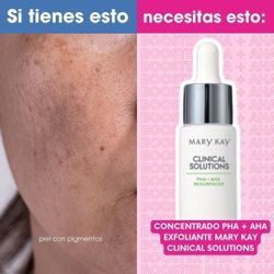 Mary Kay