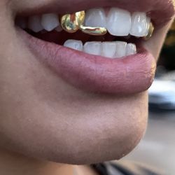 Custom Gold Grillz - Orlando Mobile Jeweler 