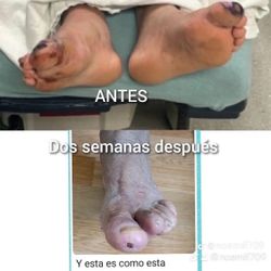Tienes Diavetes. Y Cualquier Dolor Y Enfermedad 