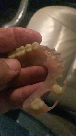 Snap in denture. Partial teeth found in m v mall parking lot.    Anyone lose it