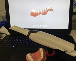 3Shape TRIOS 4 Wireless Intraoral Scanner Complete System