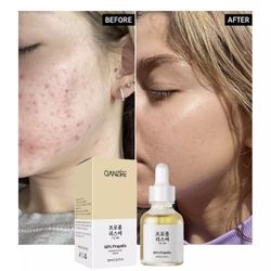 Propolis Acne Glow Serum