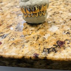 14K Gold Grillz Or You Can Do Silver 