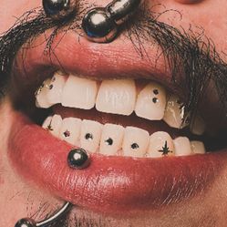Teeth Gems