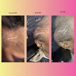 Maximum Hair Growth Oil