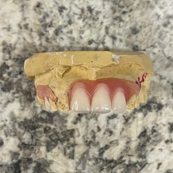Repairs For Partials, Dentures, and Retainers