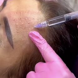 ✨ Kiara Reju Skin Booster✨