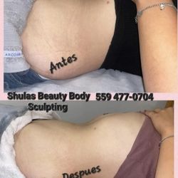 Body Sculpting Masages Masajes Reductivos 