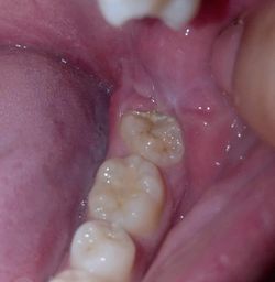 Dentist