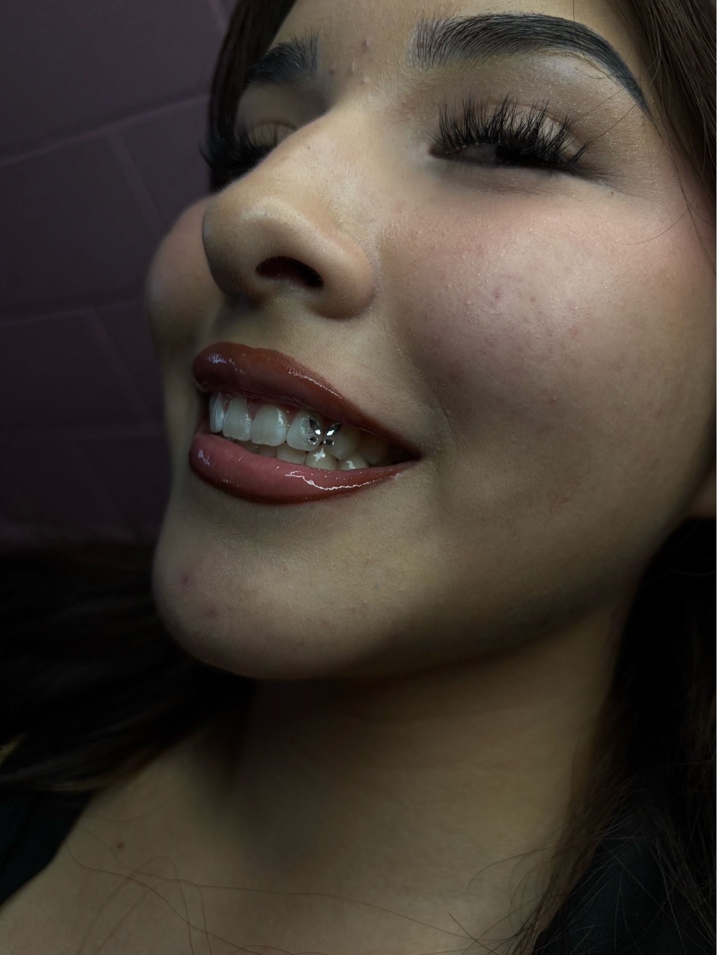 teeth whitening/ tooth gems๐