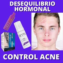 Tratamiento Para El Acne 