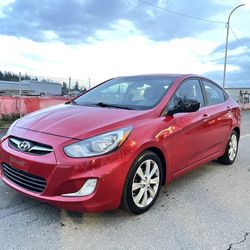 2013 Hyundai Accent