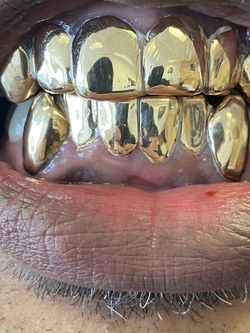GOLD GRILLZ