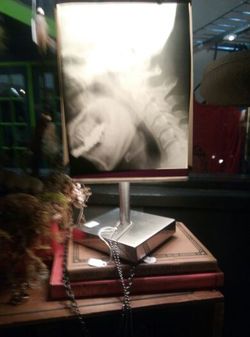 Real human xray lamp
