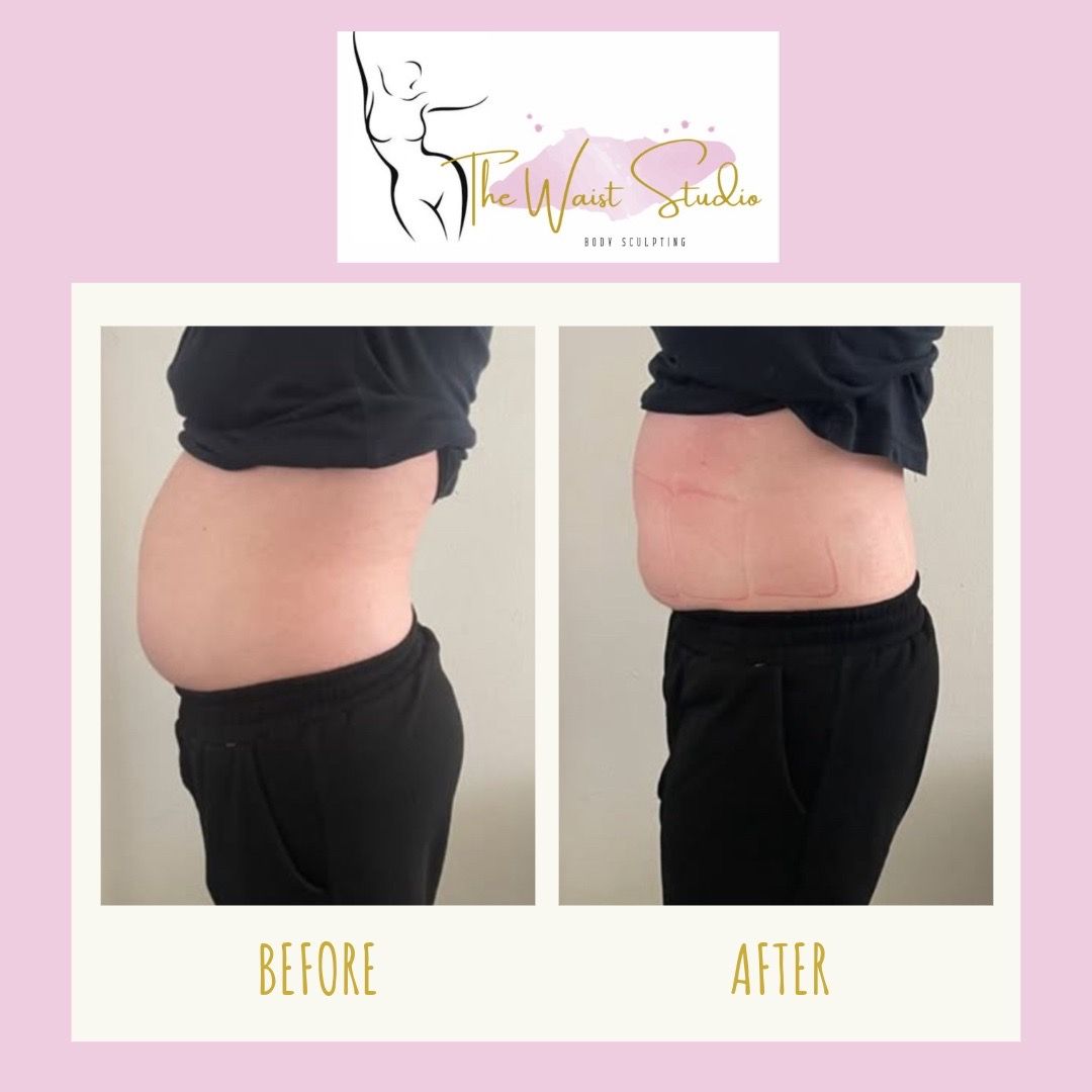 Body Fat removal