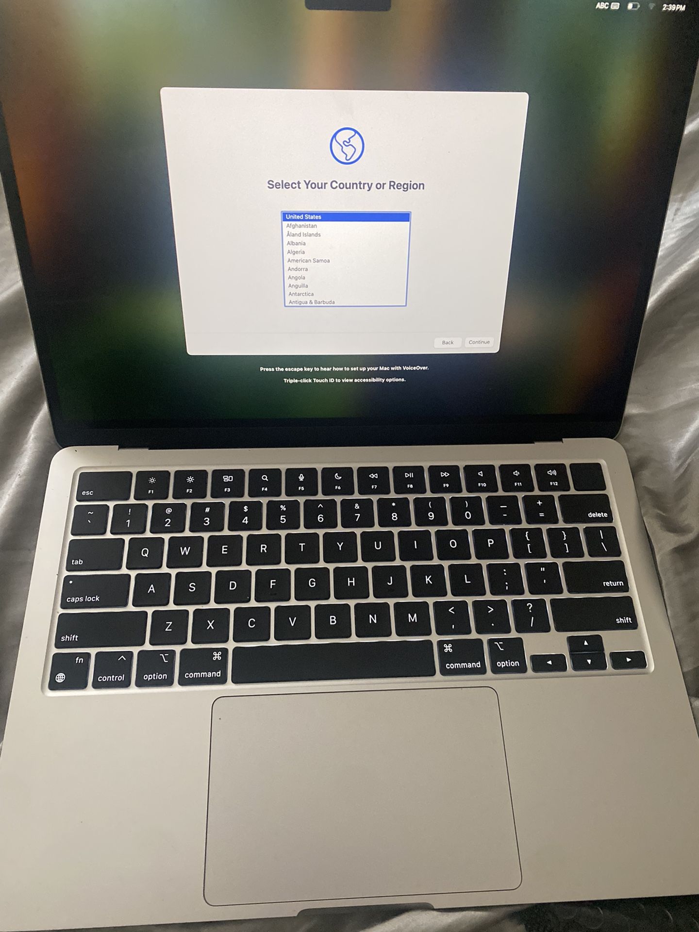 Apple 2024 MacBook Air 13-inch Laptop with M3 chip: Built for Apple Intelligence, 13.6-inch Liquid Retina Display, 16GB Unified Memory, 512GB SSD Stor