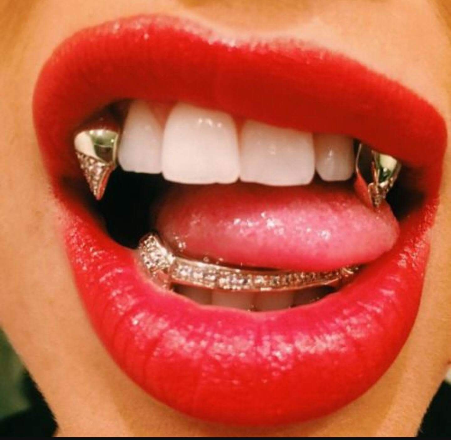 "Gold Grillz" From KDs Custom Jewelry