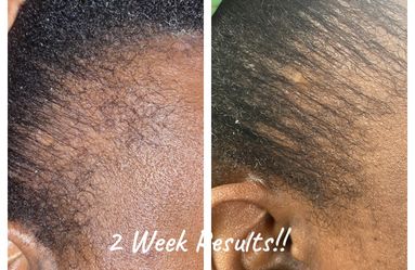 Super Hair Growth Moisturizer!!!