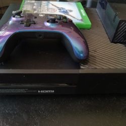 Xbox one with remote power supply might need to be replaced