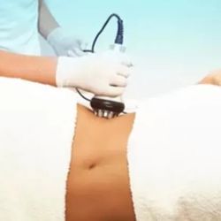 Cellulite removal, skin tightening treatment