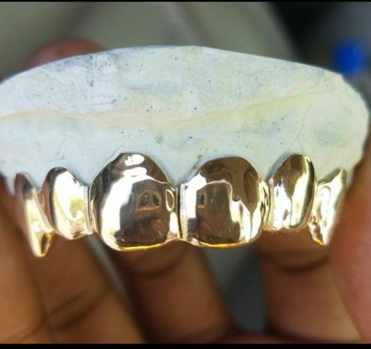Solid Gold Grillz 10k22k (Silver and Platinum also Available) for Sale