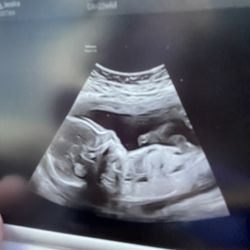 Looking For Baby Girl Preemie Clothes 