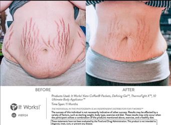 Te Gustaria Reducir Tu Abdomen Y Bajar De 10 A 40 Libras?
