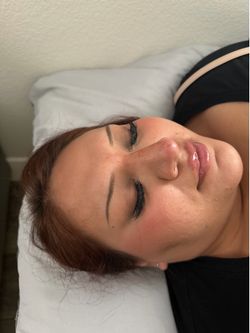 Lip filler