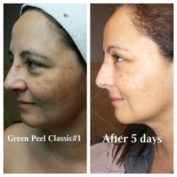 Green peel organic