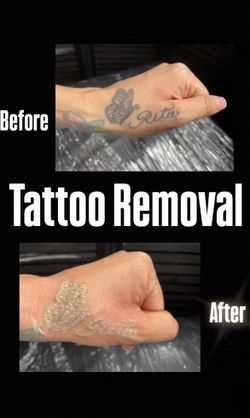Removal