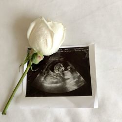 Baby Ultrasound/ Gender Reveal 