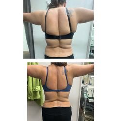 Masajes lifaticos y therapeutico