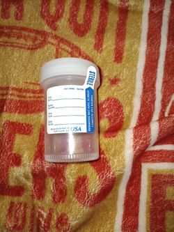 Briggs Specimen Containers, 4 oz., Sterile, Bulk Packaged Specimen Cups with Clear Top
