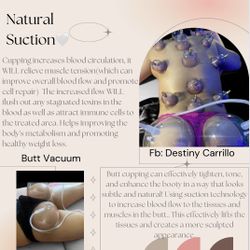 Cupping Therapy