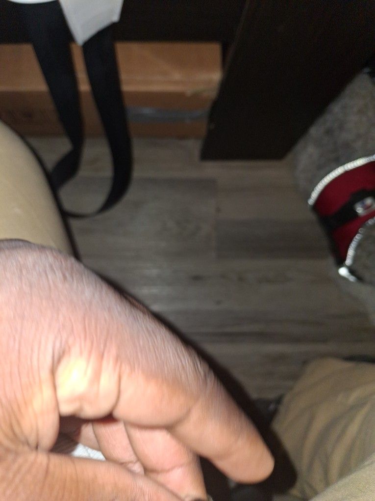 Eye Ring