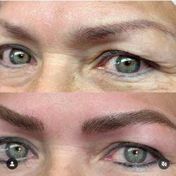 Eyebrow Microneedling