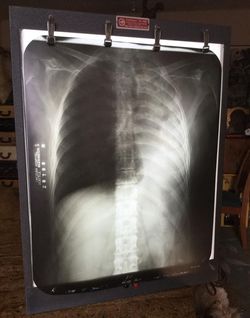 Vintage x ray reader