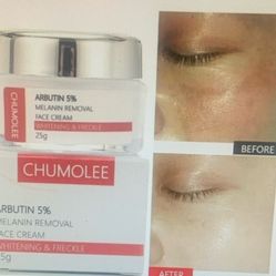 Cream For Dark Spot freckle cream