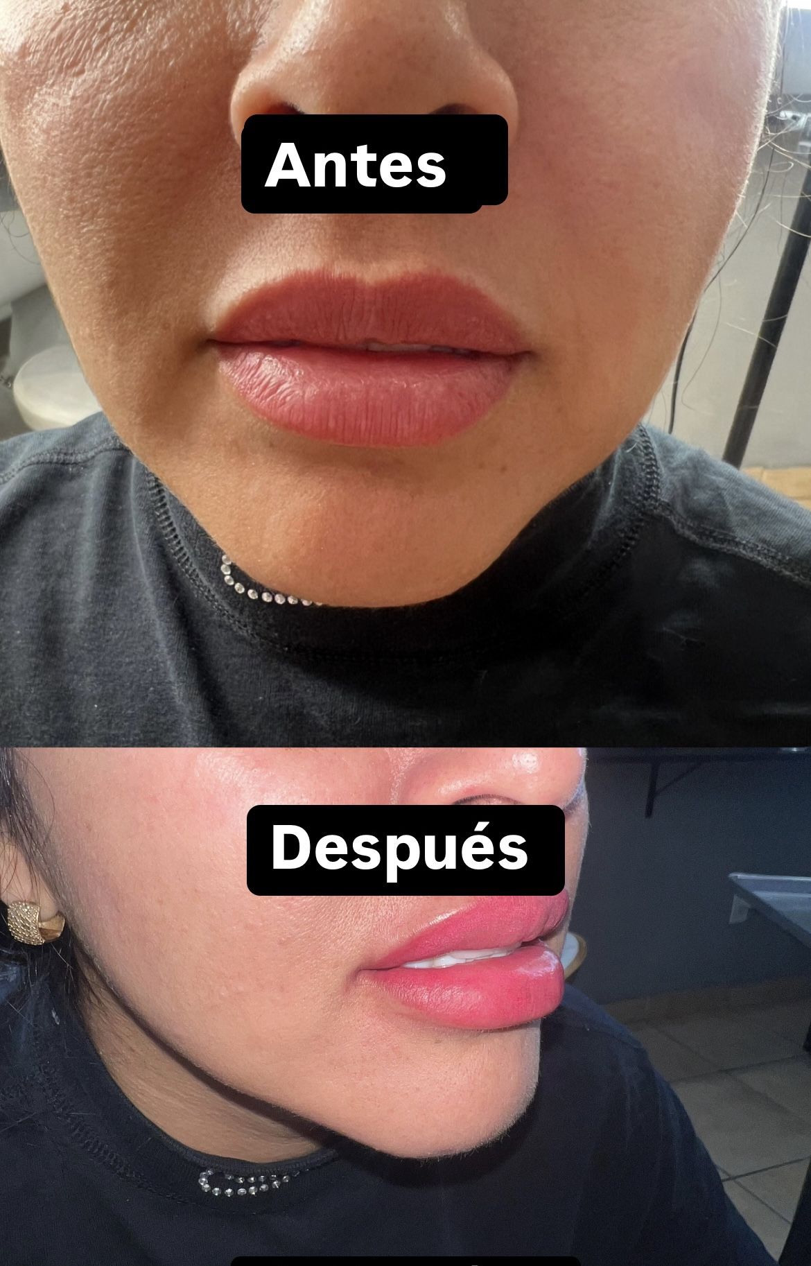 Cejas Labios NanoBlading